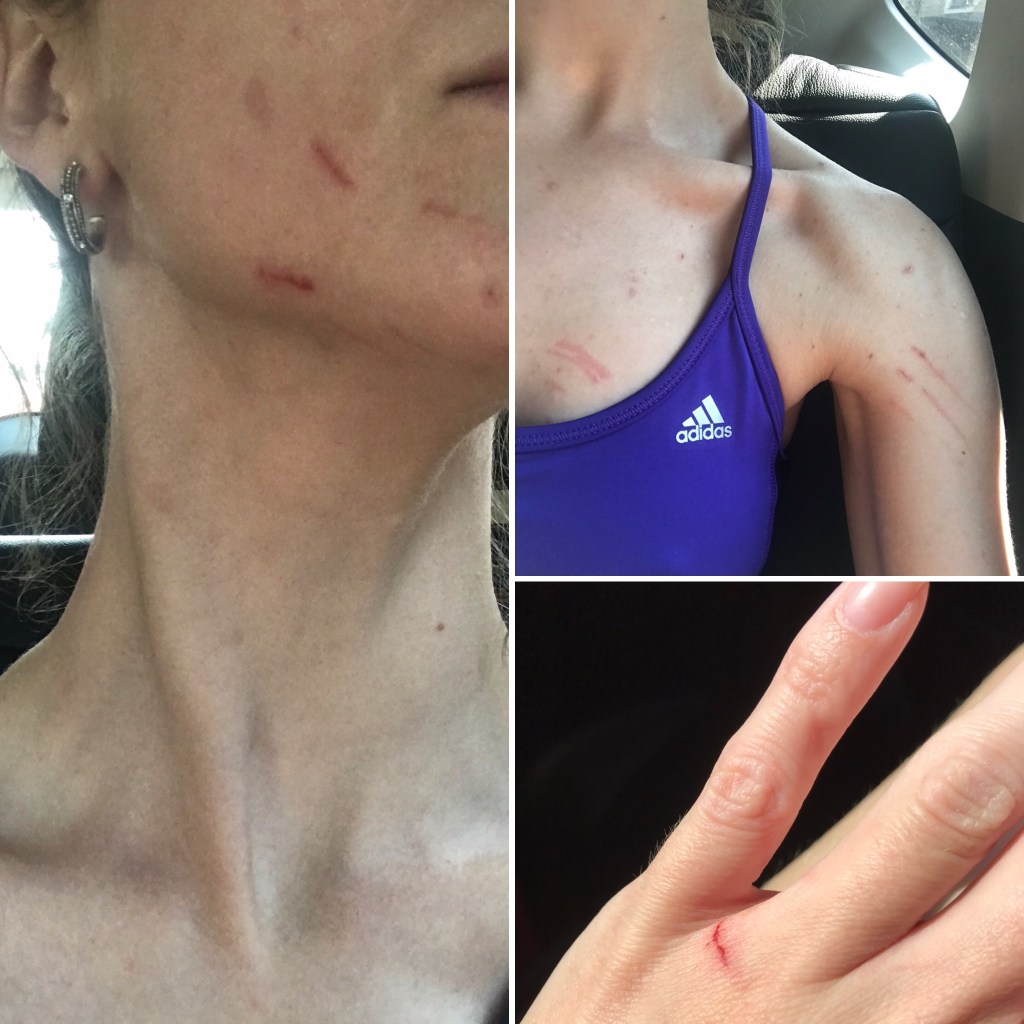 I'd never been scratched by Tropicana before, but he clearly didn't enjoy being put away after he'd managed to escape from the hutch. 😳🙄