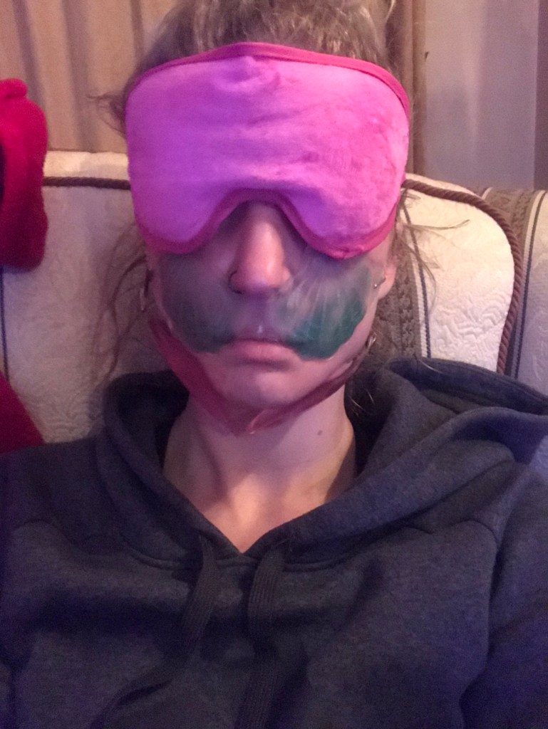 05/09 - Stress has lead to an eczema outbreak & the eye masks had to come out of the fridge & onto my face purely to reduce the inflammation & the irritating AF itching!! 😩